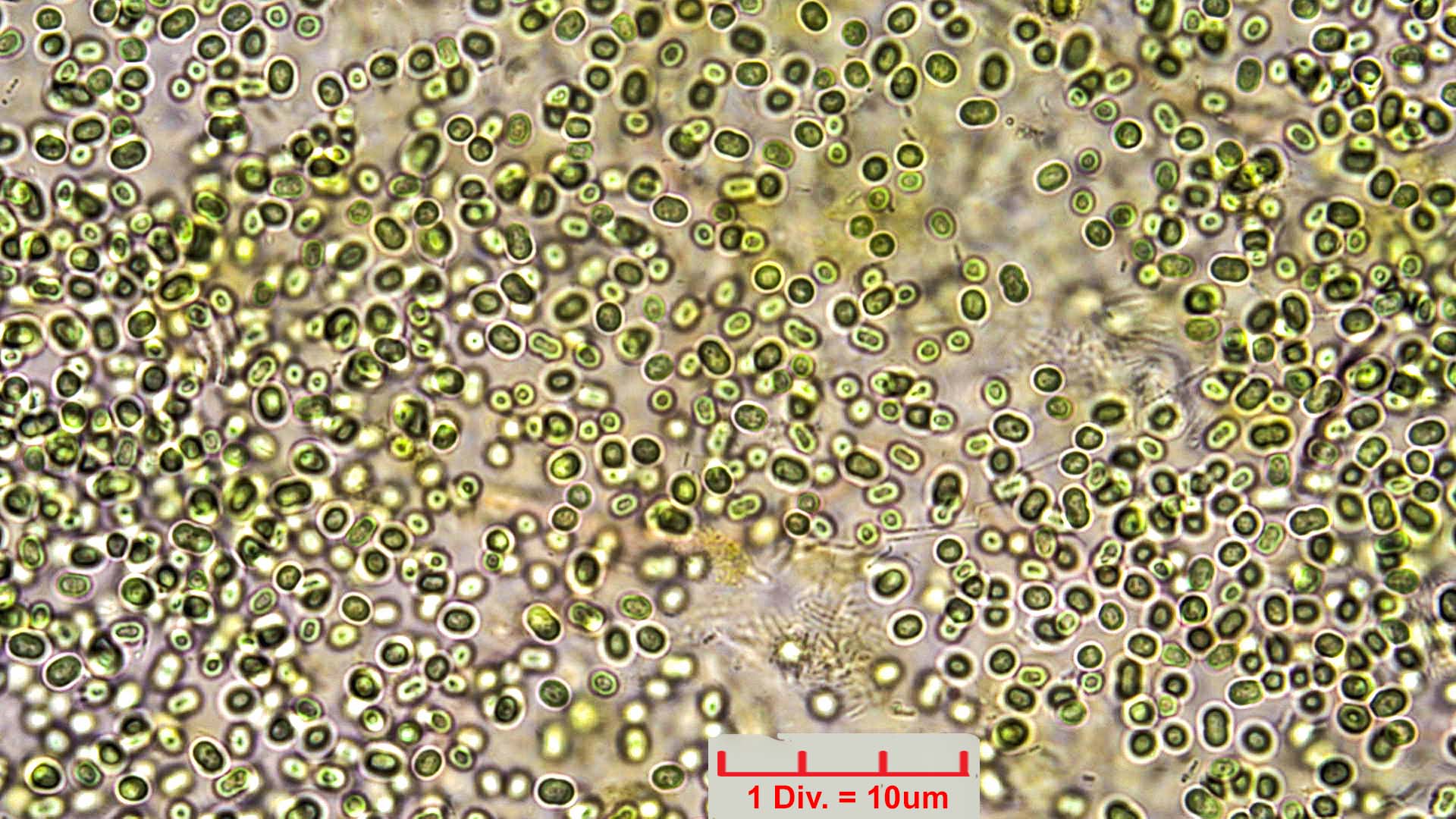./Cyanobacteria/Chroococcales/Aphanothecaceae/Aphanothece/saxicola/aphanothece-saxicola-10.jpg
