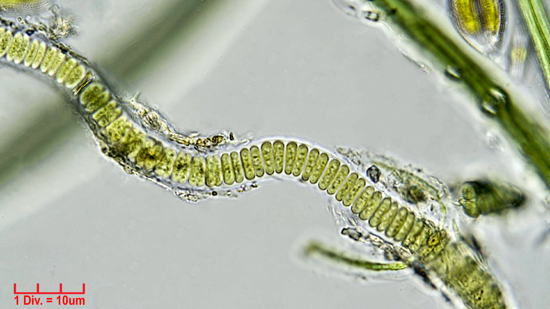 ./Cyanobacteria/Chroococcales/Cyanothricaceae/Johannesbaptistia/sp/johannesbaptistia-5.jpg