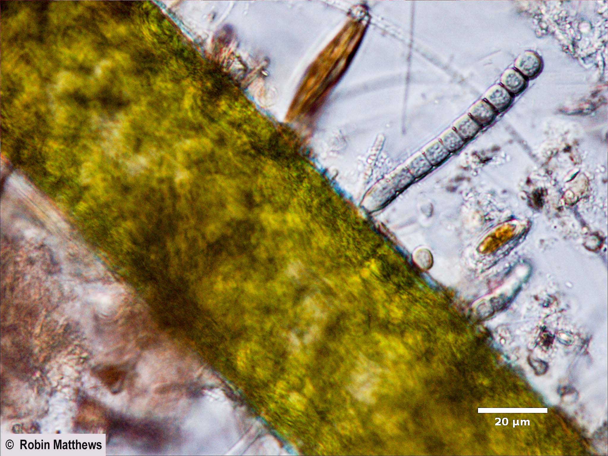 ./Cyanobacteria/Chroococcales/Stichosiphonaceae/Stichosiphon/willei/stichosiphon-willei-56.jpg