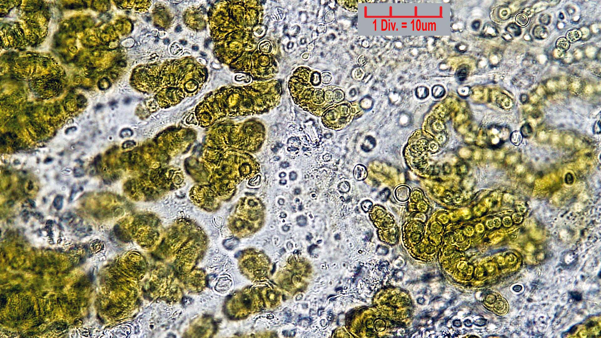Cyanobacteria/Nostocales/Nostocaceae/Nostoc/commune/nostoc-commune-598.jpg