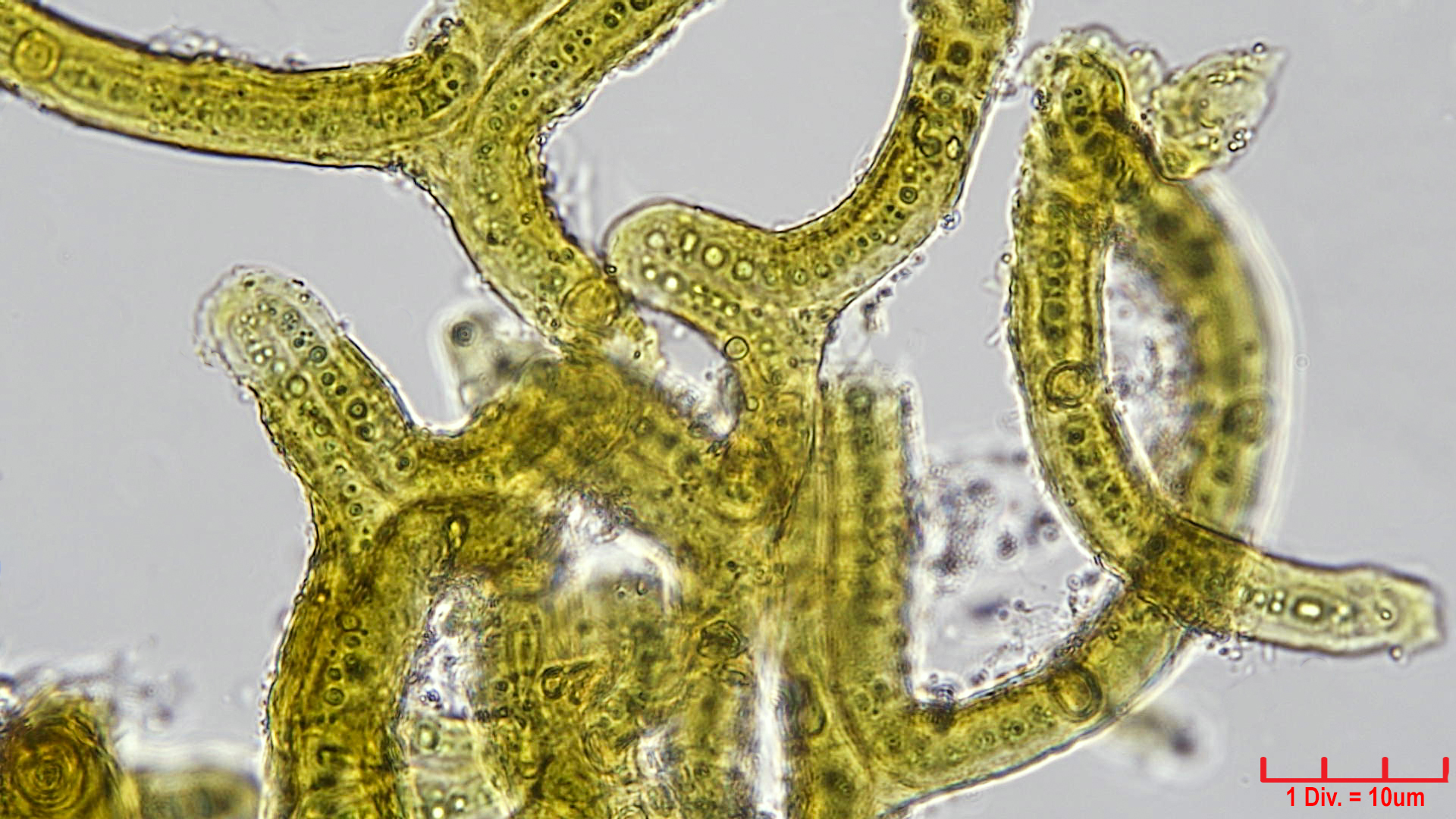 ./Cyanobacteria/Nostocales/Scytonemataceae/Petalonema/incrustans/petalonema-incrustans-417.jpg