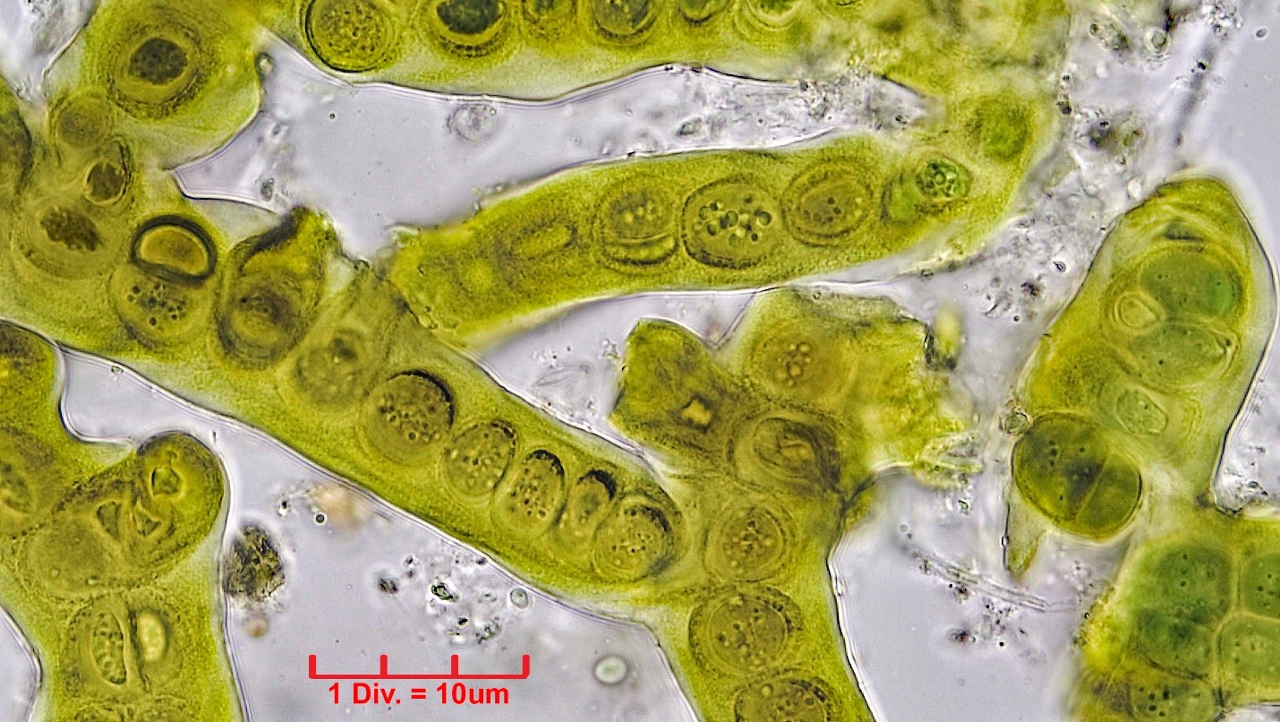 ./Cyanobacteria/Nostocales/Stigonemataceae/Stigonema/informe/stigonema-informe-521.jpg