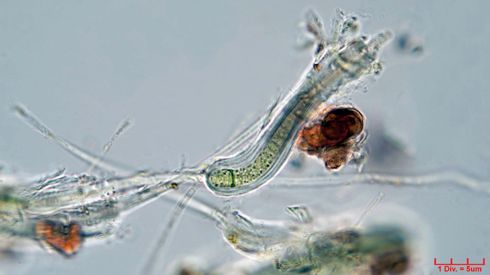 Cyanobacteria/Oscillatoriales/Homeotrichaceae/Phormidiochaete/sp/phormidiochaete-304.png