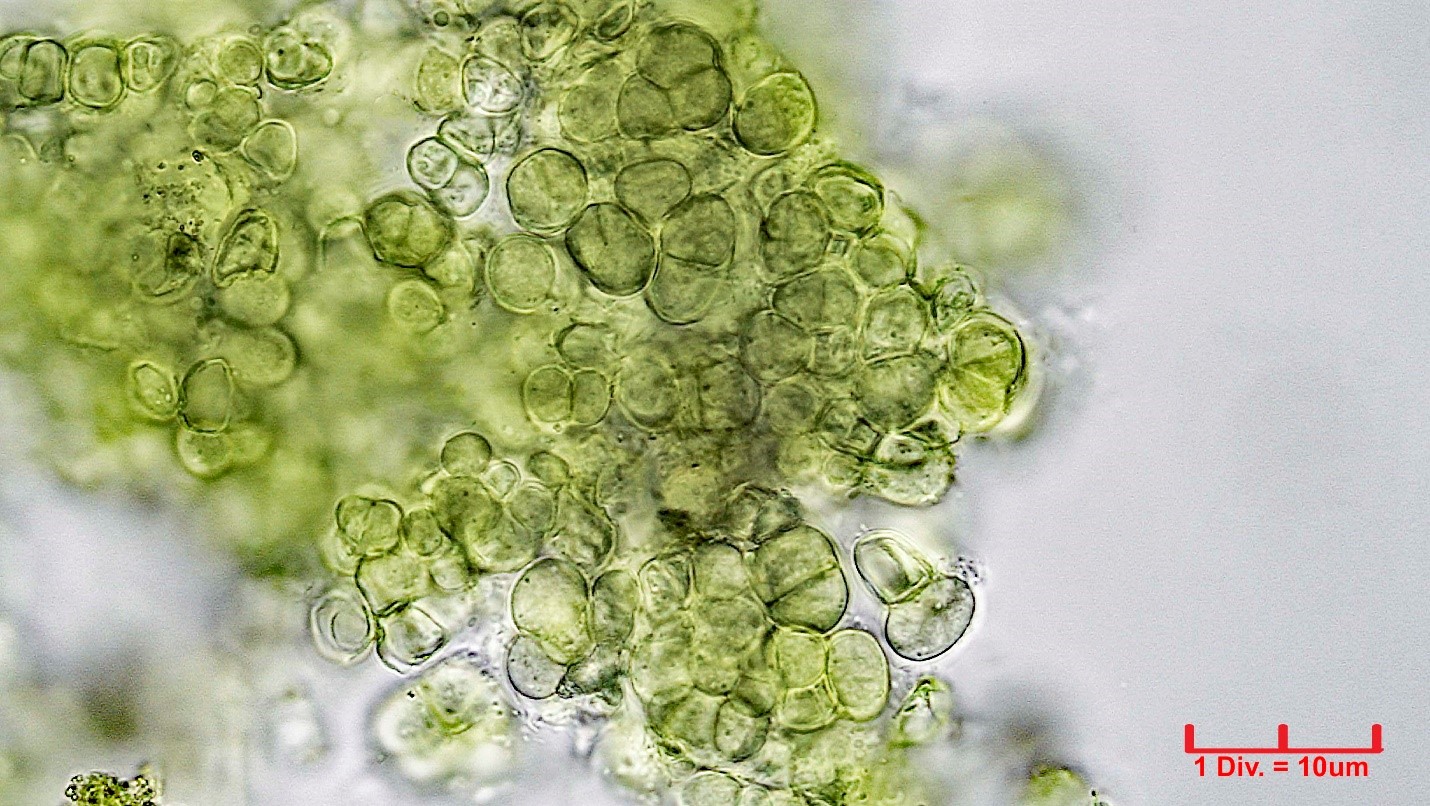 ./Cyanobacteria/Pleurocapsales/Hyellaceae/Pleurocapsa/sp/pleurocapsa-160.jpg