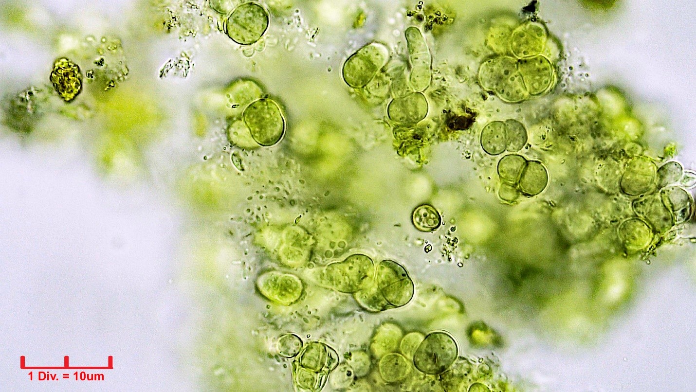 ./Cyanobacteria/Pleurocapsales/Hyellaceae/Pleurocapsa/sp/pleurocapsa-161.jpg