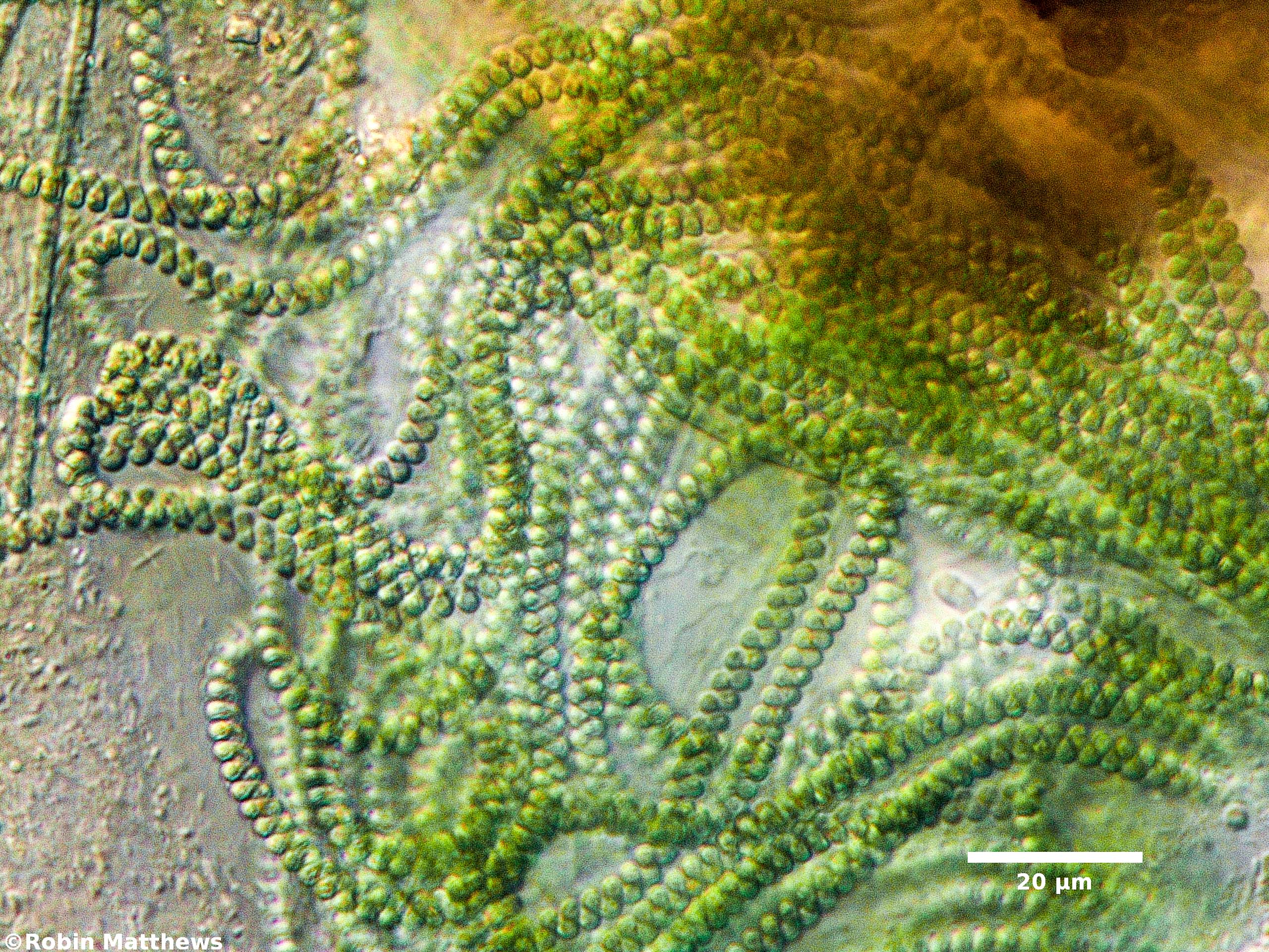 ./Cyanobacteria/Spirulinales/Spirulinaceae/Spirulina/major/spirulina-major-149.jpg