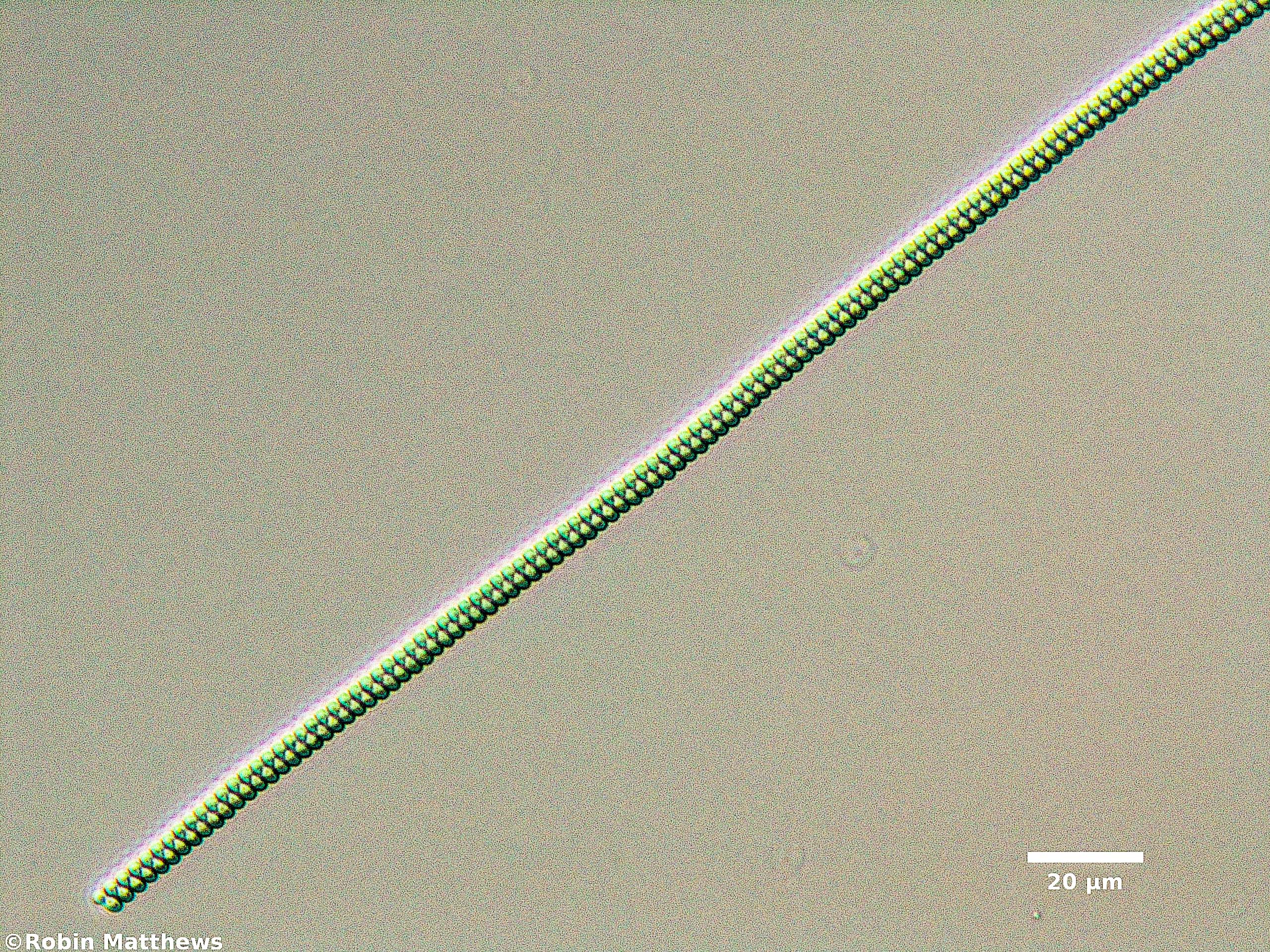 ./Cyanobacteria/Spirulinales/Spirulinaceae/Spirulina/major/spirulina-major-151.jpg