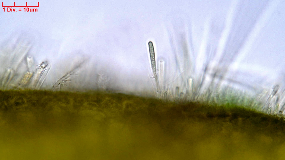 Cyanobacteria/Synechococcales/Chamaesiphonaceae/Chamaesiphon/convervicolus/chamaesiphon-convervicolus-81.png