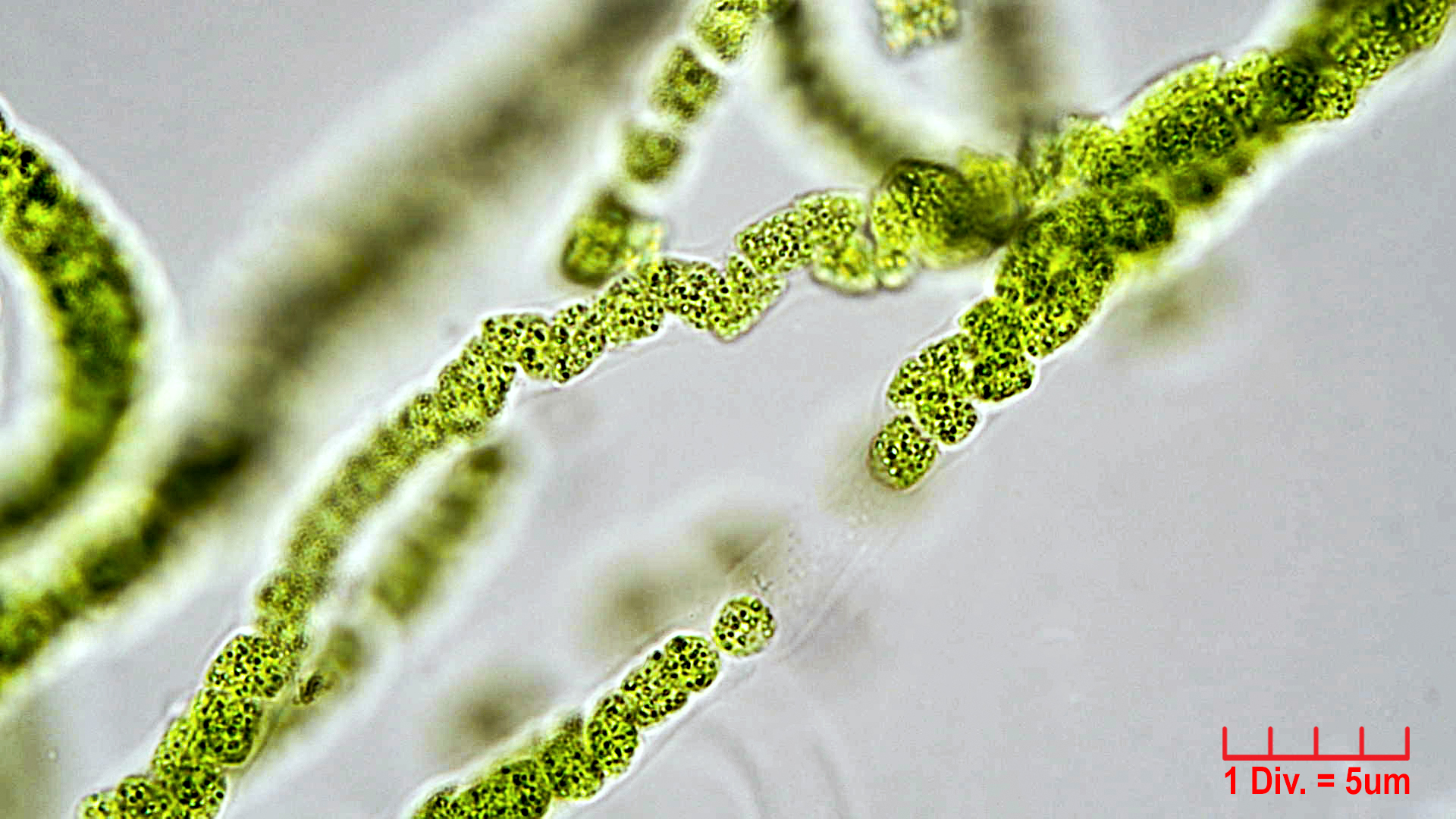 ./Cyanobacteria/Unknown/1004.jpg